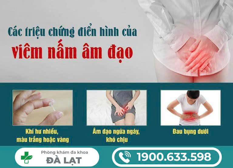 Hình ảnh minh họa